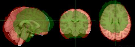 flirt fsl|fsl neuroimage.